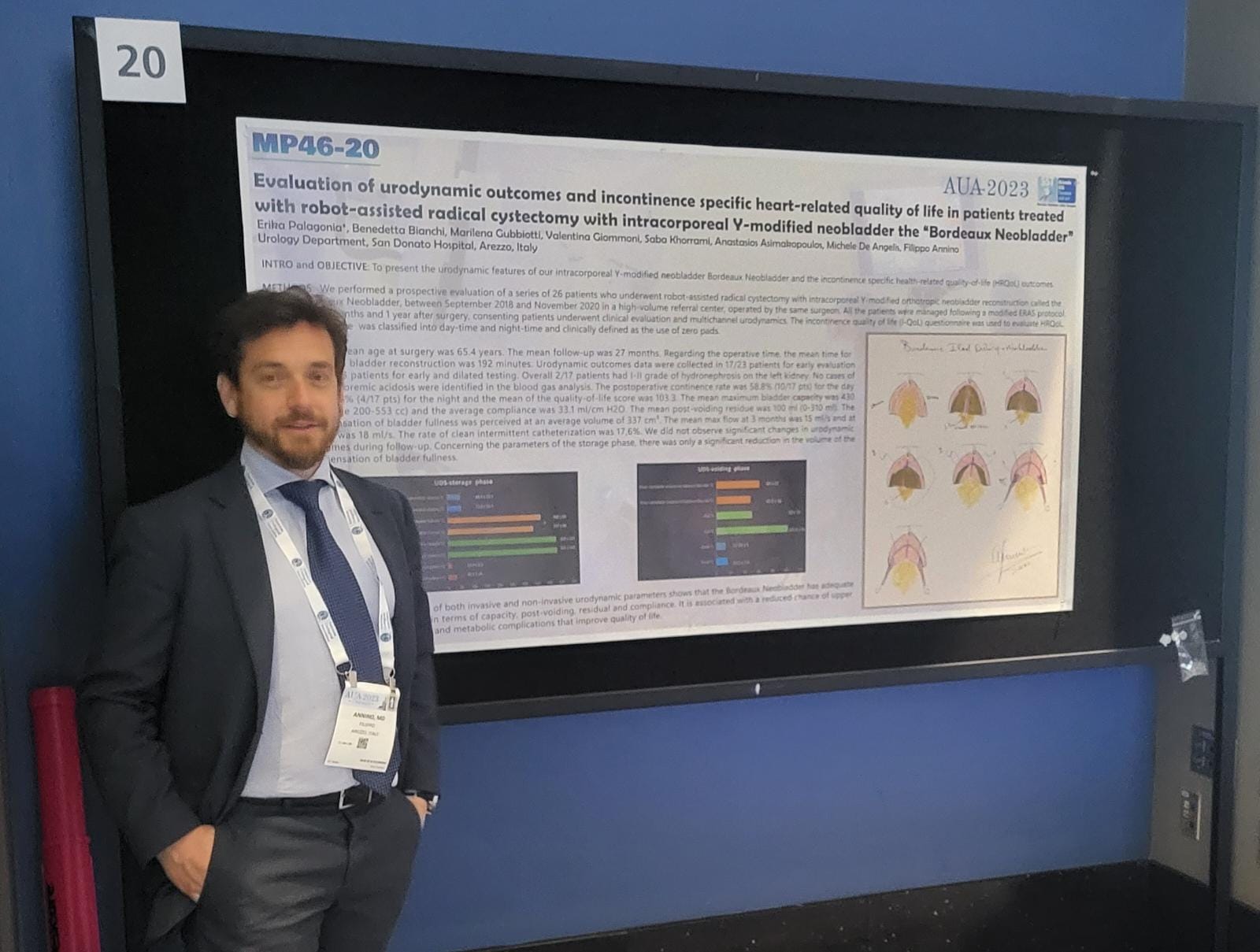 Robotica in Urologia buoni risultati in evidenza da studio del